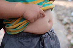 Хирург рассказал о влиянии детского ожирения на взрослую жизнь человека